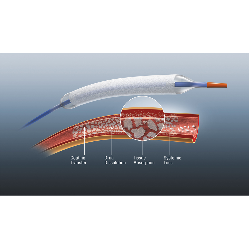 Agentᵀᴹ DCB Mit Wirkstofffreisetzung | Boston Scientific